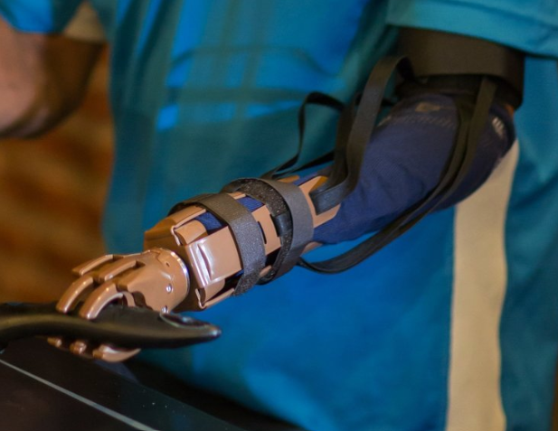 Prosthetic Hand Interface